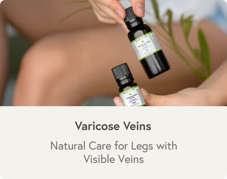 Varicose Veins Formula