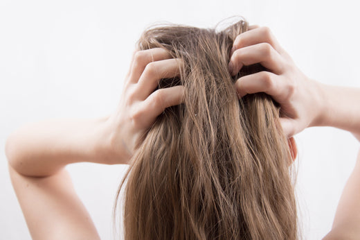 How to Help an Itchy Scalp